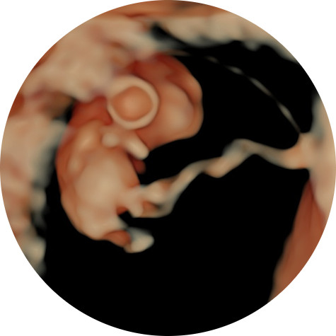 spire-clinic-for-pregnancy-scan-8.jpeg