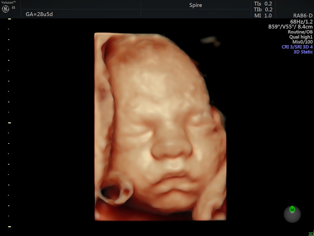 spire-clinic-for-pregnancy-scan-9.jpeg